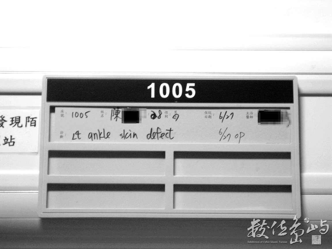 開刀完馬上入院