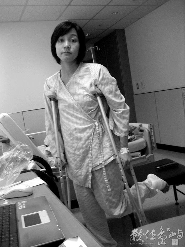 等待第二次手術