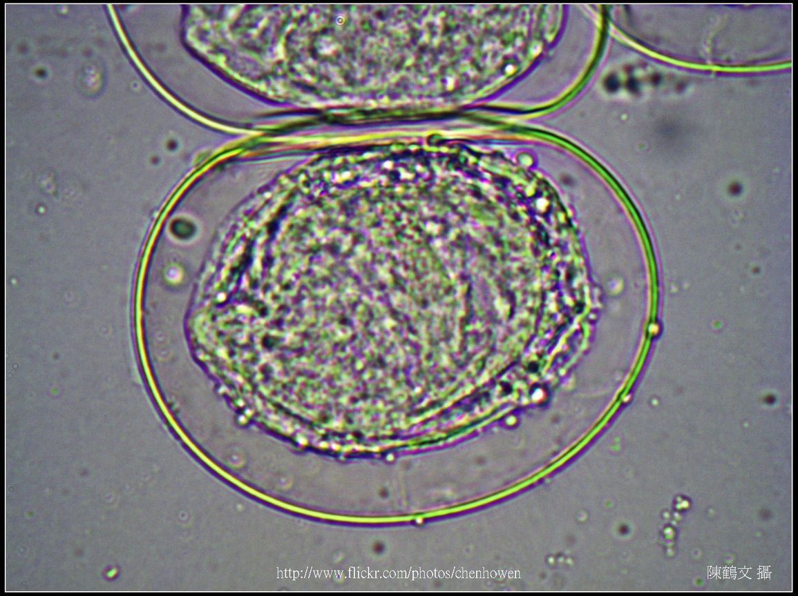 600X光學_血吸蟲 卵裝片 (生活史包括成蟲、卵、毛蚴、胞蚴、尾蚴及童蟲等6�