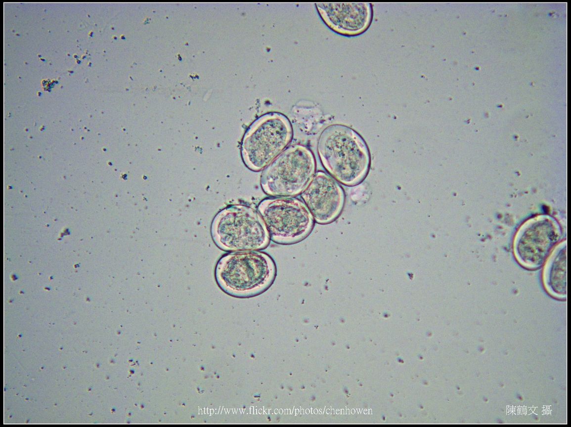 100X光學_血吸蟲 卵裝片 (生活史包括成蟲、卵、毛蚴、胞蚴、尾蚴及童蟲等6�