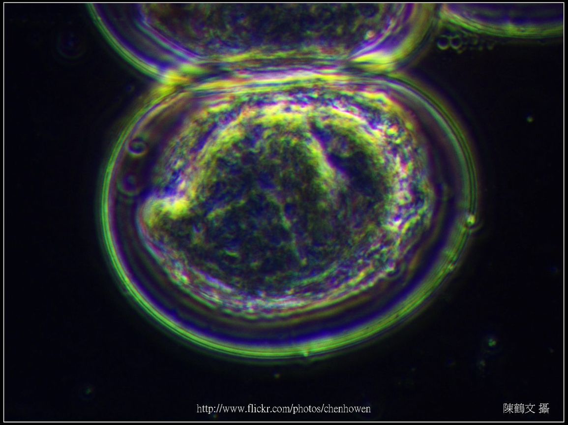 600X相位差_血吸蟲 卵裝片 (特別用Phase鏡頭拍出立體感).jpg