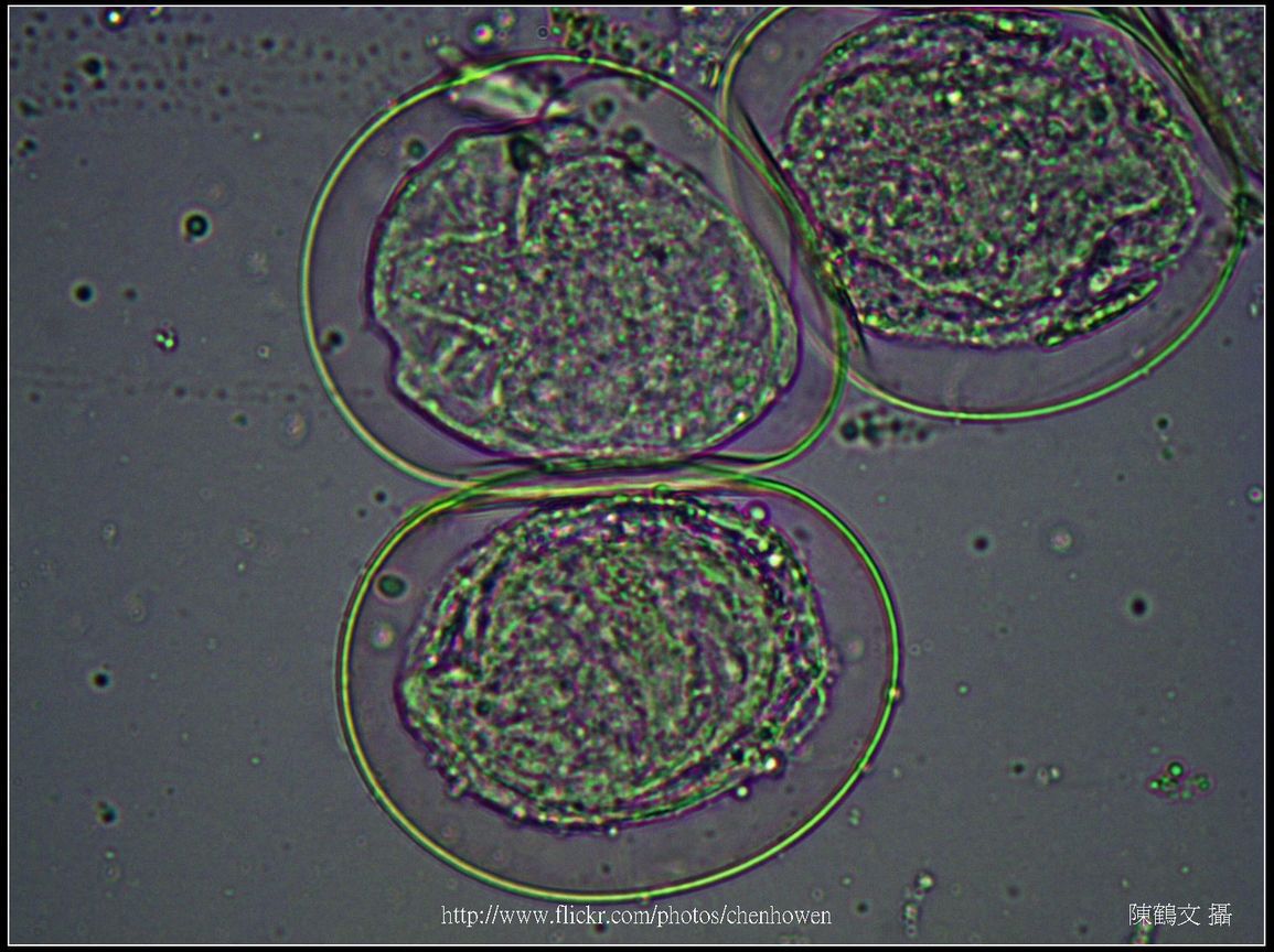 400X光學_血吸蟲 卵裝片 (生活史包括成蟲、卵、毛蚴、胞蚴、尾蚴及童蟲等6�
