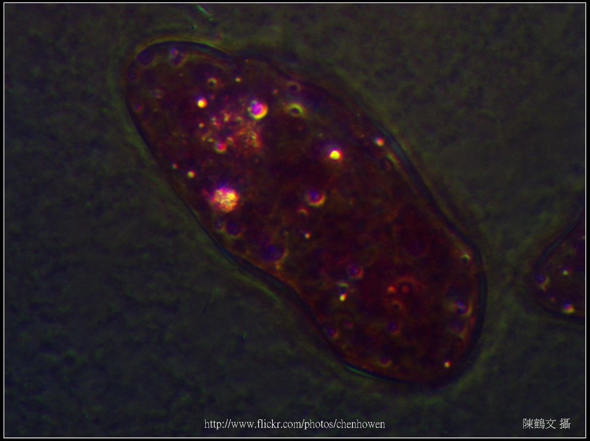 600X相位差_血吸蟲 毛蚴 (生活史包括成蟲、卵、毛蚴、胞蚴、尾蚴及童蟲等6�