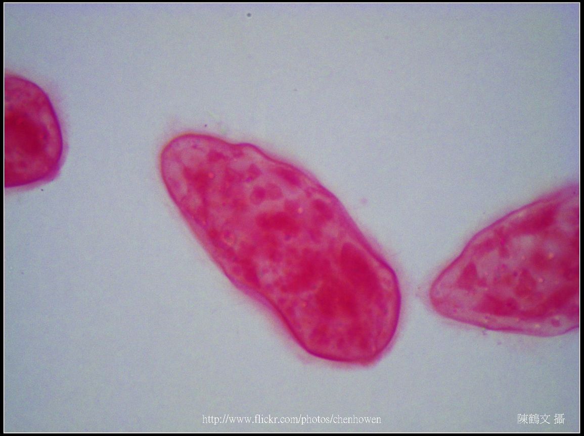 400X光學_血吸蟲 毛蚴 (生活史包括成蟲、卵、毛蚴、胞蚴、尾蚴及童蟲等6個�