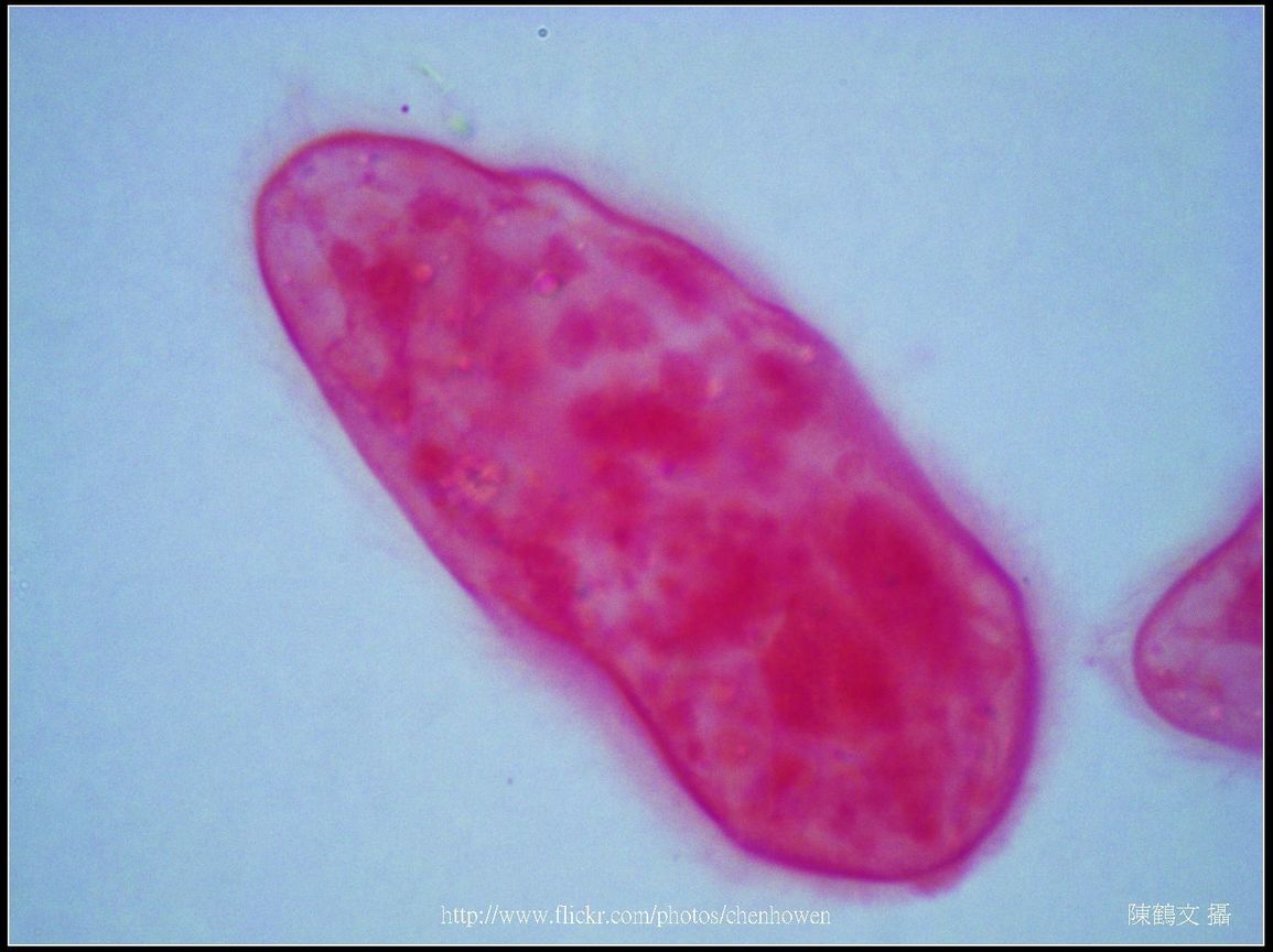 600X光學_血吸蟲 毛蚴 (生活史包括成蟲、卵、毛蚴、胞蚴、尾蚴及童蟲等6個�