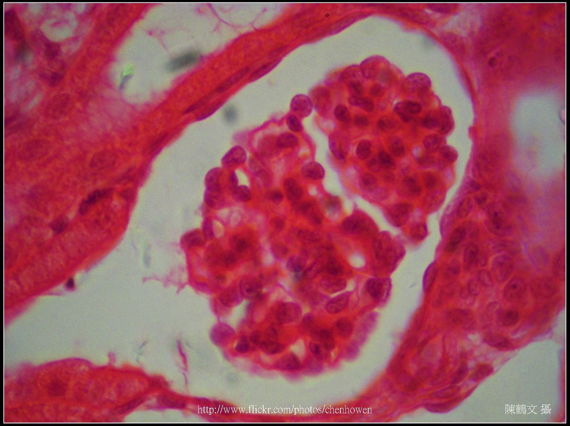 600X光學_腎臟_腎小球.jpg
