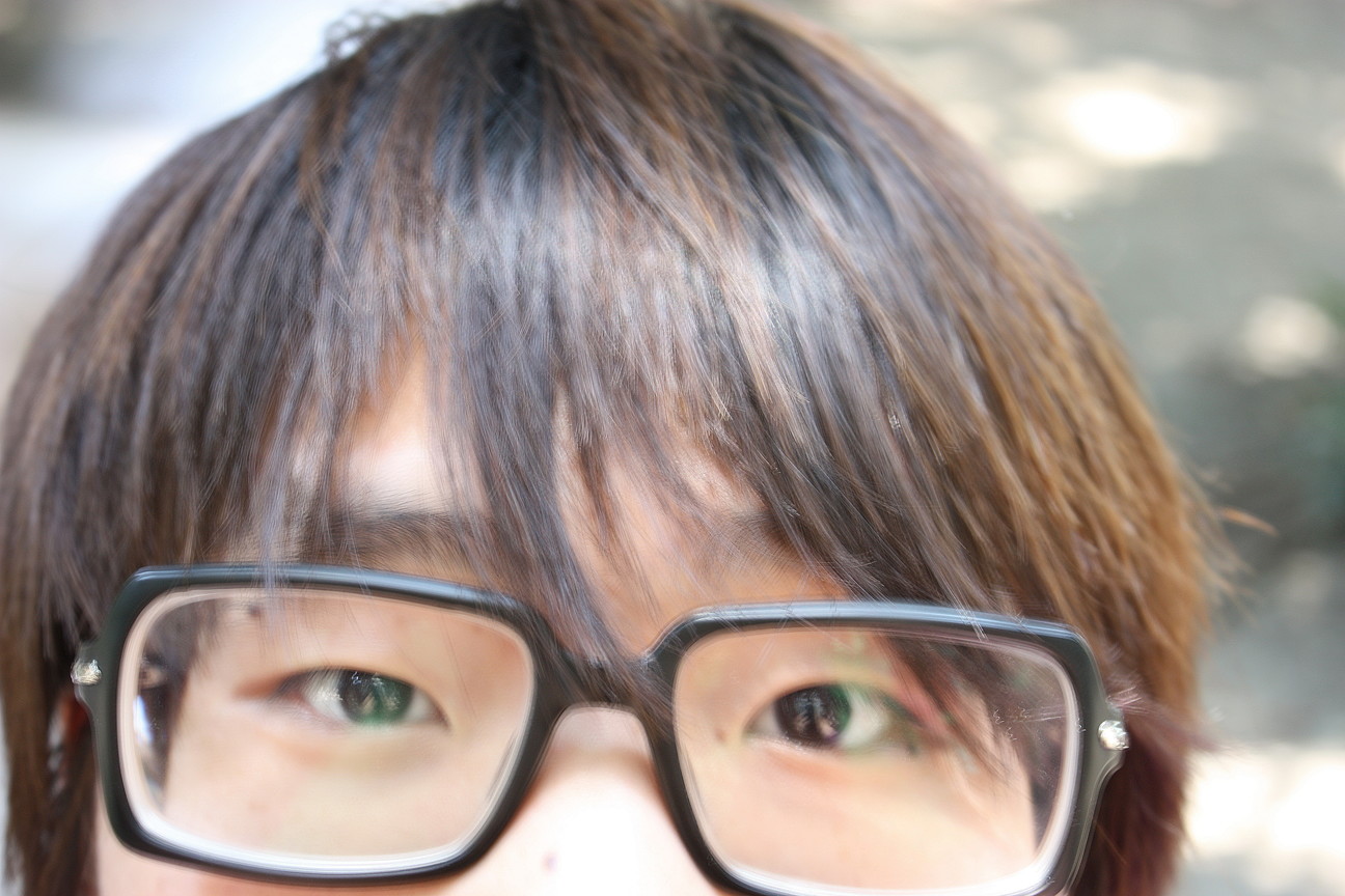 大頭痣王