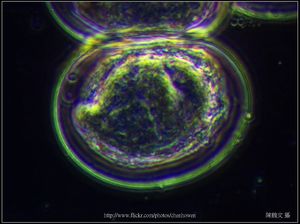 600X相位差_血吸蟲 卵裝片 (特別用Phase鏡頭拍出立體感).jpg