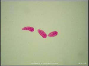 100X光學_血吸蟲 毛蚴 (生活史包括成蟲、卵、毛蚴、胞蚴、尾蚴及童蟲等6個�