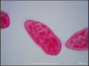 400X光學_血吸蟲 毛蚴 (生活史包括成蟲、卵、毛蚴、胞蚴、尾蚴及童蟲等6個�
