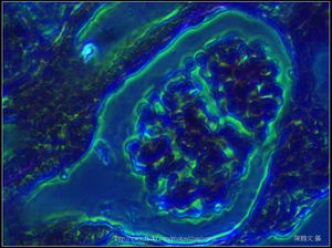 600X相位差_腎臟_腎小球_Without White Balance.jpg